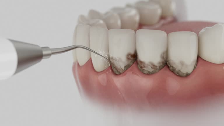 Reliable Root Canal Treatment contractor in Winona County County, MN by Dentist Open Now
